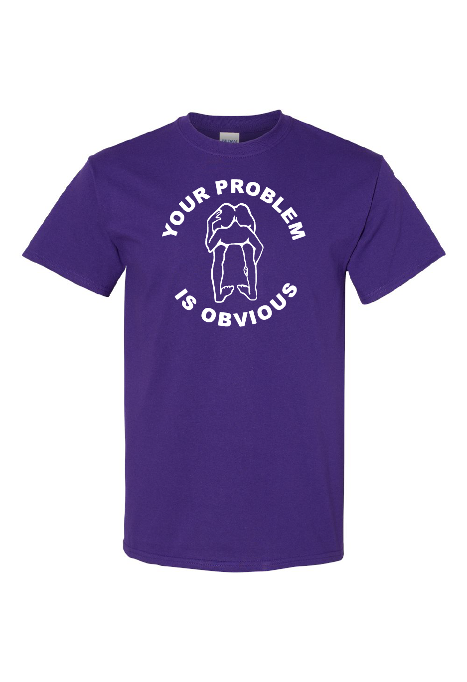 Your Problem Is Obvious